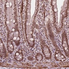 Anti-GTF3C5 Antibody