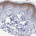 Anti-CTNNBIP1 Antibody