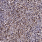 Anti-UNC13D Antibody