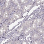 Anti-UNC13D Antibody