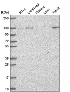 Anti-UNC13D Antibody