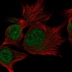 Anti-C15orf65 Antibody