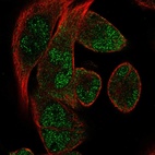 Anti-RBM24 Antibody