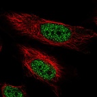 Anti-ARIH2 Antibody