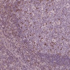 Anti-ING3 Antibody