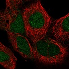 Anti-MAN2C1 Antibody