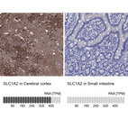 Anti-SLC1A2 Antibody