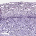 Anti-GABRB2 Antibody