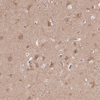 Immunohistochemical staining of human cerebral cortex shows moderate positivity in nucleoli in neurons.