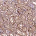 Immunohistochemical staining of human kidney shows moderate positivity in nucleoli in cells in tubules.