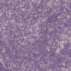 Anti-PARP3 Antibody