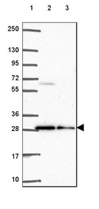 Lane 1: Marker [kDa] 250, 130, 95, 72, 55, 36, 28, 17, 10_br/_Lane 2: Human cell line RT-4_br/_Lane 3: Human cell line U-251 MG