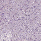 Anti-GPR37 Antibody