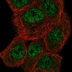 Immunofluorescent staining of human cell line MCF7 shows localization to nucleoplasm.