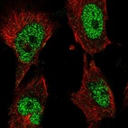 Anti-POLK Antibody