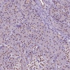 Anti-CTR9 Antibody