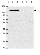 Anti-CTR9 Antibody