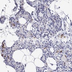 Anti-RCAN1 Antibody