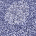 Anti-RCAN1 Antibody