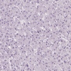 Anti-POLR3D Antibody