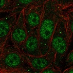 Anti-PCBP1 Antibody