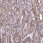 Anti-FASTKD3 Antibody