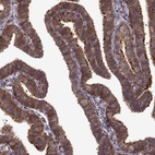 Anti-IFRD2 Antibody