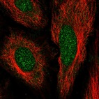 Immunofluorescent staining of human cell line HeLa shows localization to nucleoplasm.