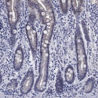 Anti-ATP6V1G2 Antibody