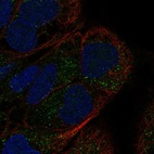 Anti-GDF7 Antibody