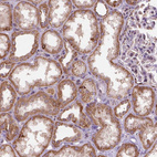 Anti-FZD7 Antibody