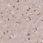 Anti-FZD7 Antibody