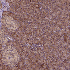 Anti-FZD7 Antibody