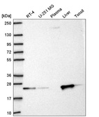 Anti-KBTBD8 Antibody