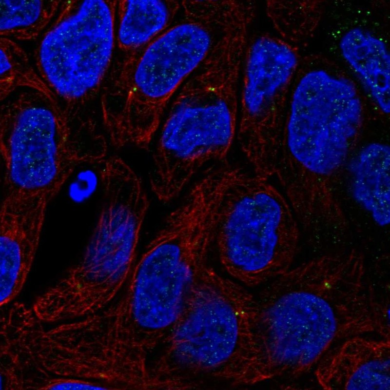 Anti-TTC6 Antibody