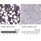 Anti-PLCB2 Antibody