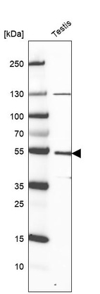 Anti-LRR1 Antibody