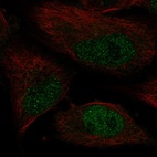 Anti-POLK Antibody