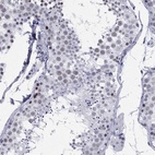 Anti-ASF1B Antibody