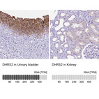 Anti-DHRS2 Antibody