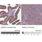 Anti-WARS2 Antibody