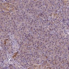 Anti-WARS2 Antibody