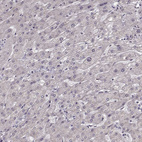 Immunohistochemical staining of human liver shows no positivity in hepatocytes as expected.