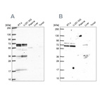 Anti-GTF3C5 Antibody