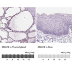 Anti-ZMAT4 Antibody