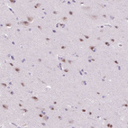 Anti-ZMAT4 Antibody