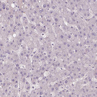 Anti-ZMAT4 Antibody