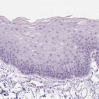 Anti-ZMAT4 Antibody