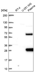 Anti-SCHIP1 Antibody