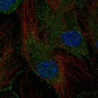 Immunofluorescent staining of human cell line HUVEC TERT2 shows localization to nucleoplasm, plasma membrane, cytosol & cell junctions.